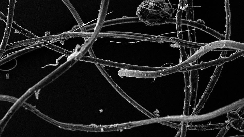 Case Study by Plymouth University - Cleaner Seas Group 3 Microsplastics Microscopic